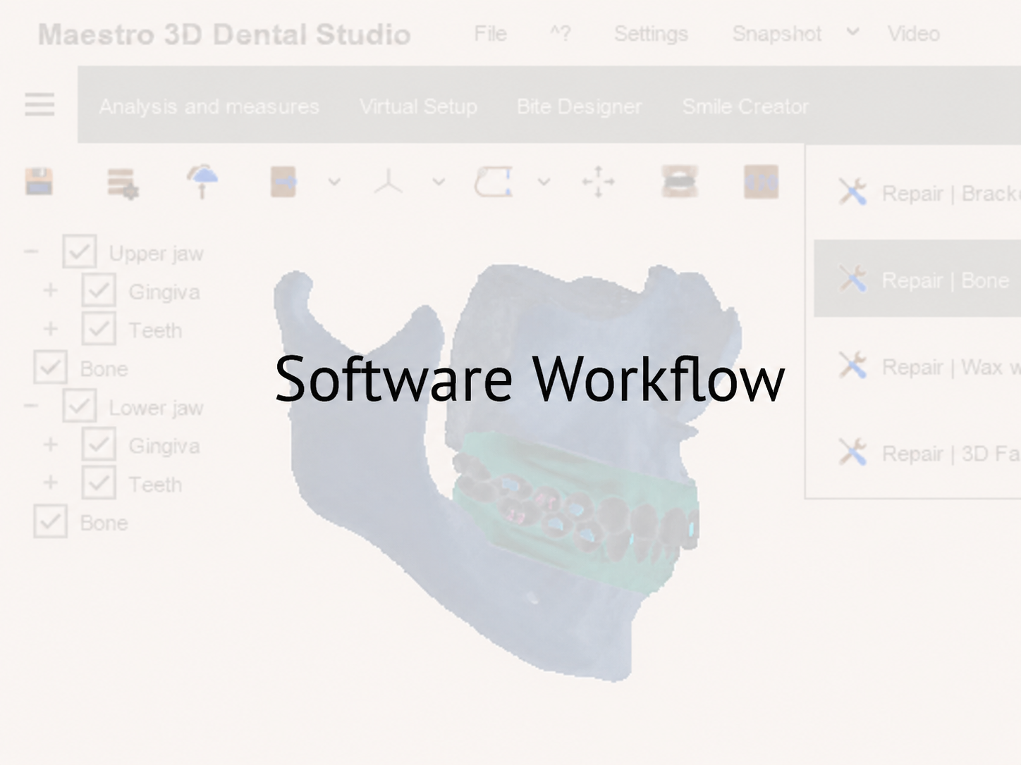 Module 1 - Software workflow: From Model Import to Tooth Movement